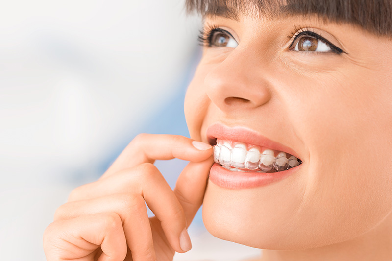 invisalign Belle Chasse